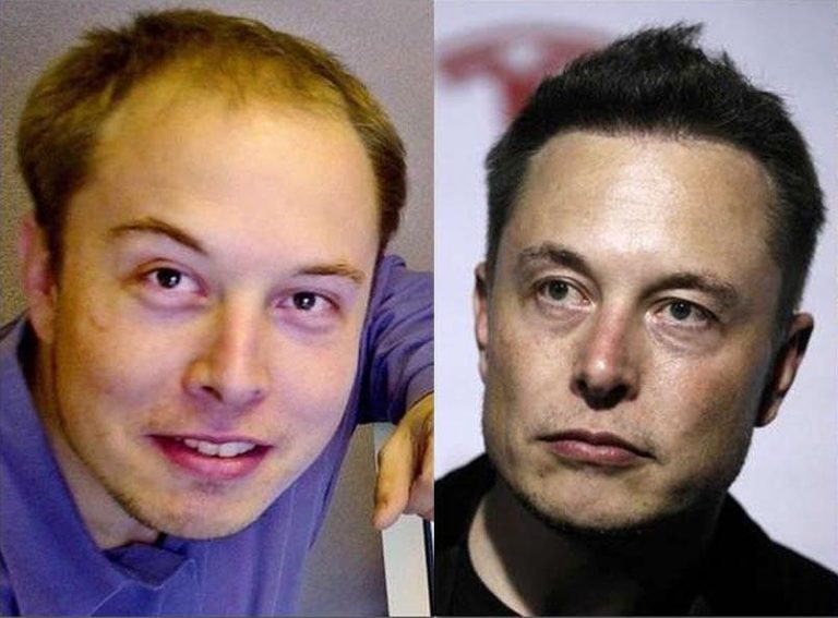 ELON MUSK (53)