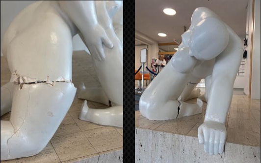 MÓÐIR JÖRÐ FÓTBROTIN Á LANDSPÍTALA